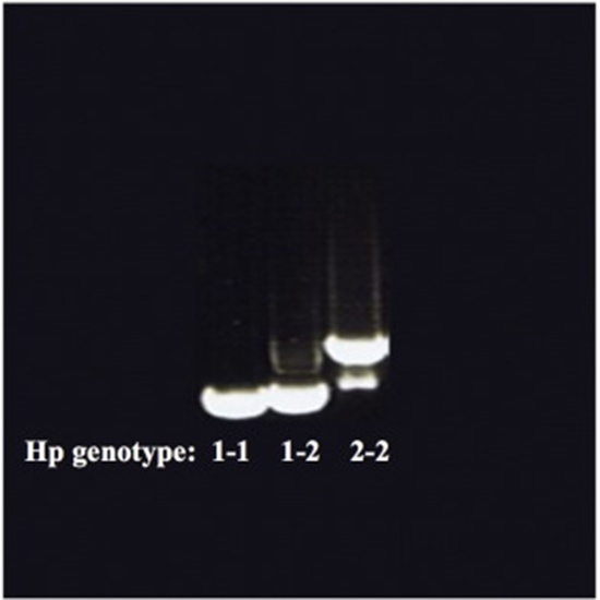 haptoglobin genotype test